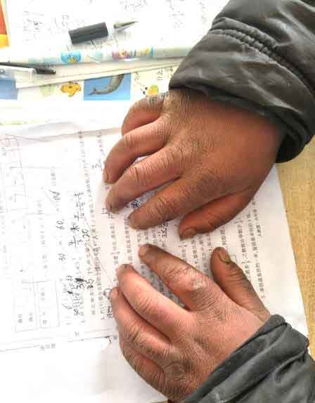 云南留守男孩冒冰霜上學，結成“冰花”獲網友鼓勵，看著讓人心疼02.jpg